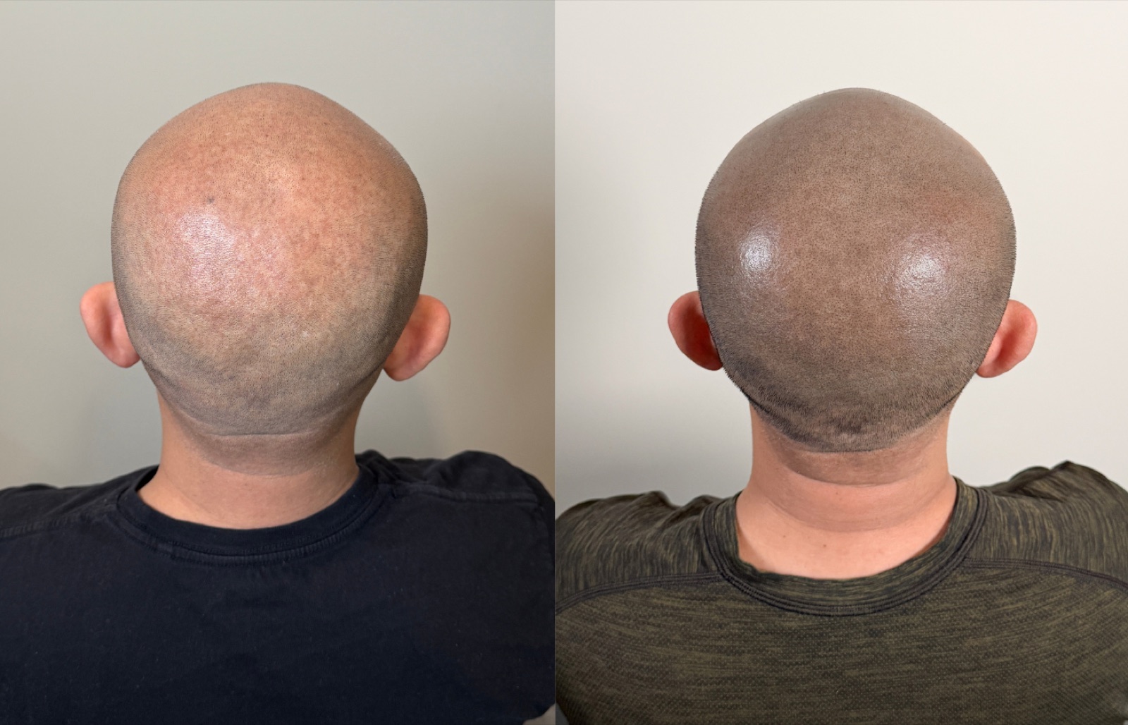 Shaved look SMP portfolio 12
